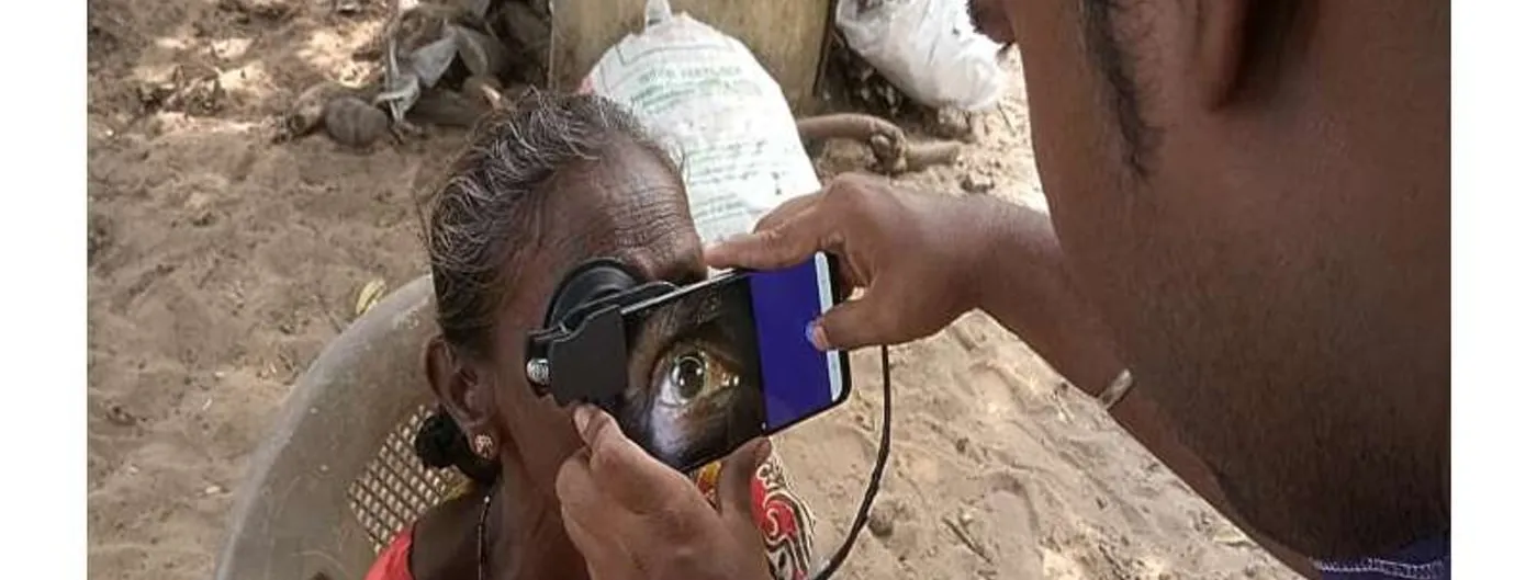 A health worker at a rural outdoor eye camp holds a silicone-cupped smartphone attachment against a patient's eye, the phone screen showing a magnified live view of her eye.