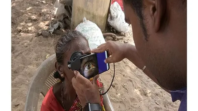 A health worker at a rural outdoor eye camp holds a silicone-cupped smartphone attachment against a patient's eye, the phone screen showing a magnified live view of her eye.