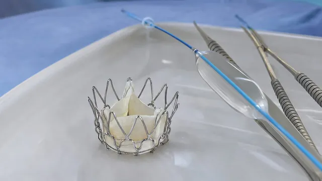 A generic expandable prosthetic heart valve with a thin metal wire frame and pale leaflets sits on a sterile tray in an operating room, beside a balloon catheter and two surgical forceps.