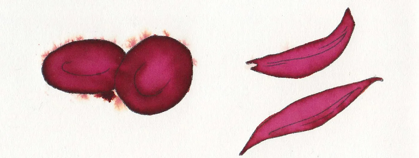 A watercolour illustration comparing red blood cells: two rounded discs labelled normal blood cells on the left, and two long curved crescents labelled sickled blood cells on the right.