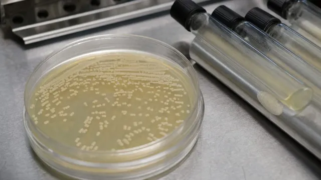 An open petri dish on a stainless steel bench holds pale bacterial colonies scattered across amber agar, with capped glass culture tubes lying beside it.
