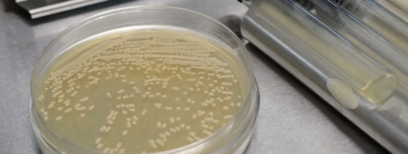An open petri dish on a stainless steel bench holds pale bacterial colonies scattered across amber agar, with capped glass culture tubes lying beside it.