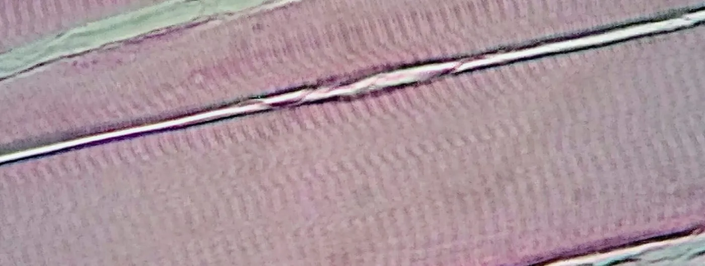 A light-microscope photomicrograph of skeletal muscle tissue at 400x magnification, showing parallel striated muscle fibres in cross and oblique section.