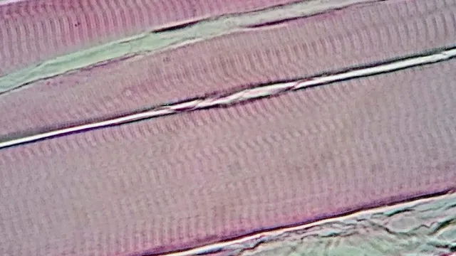 A light-microscope photomicrograph of skeletal muscle tissue at 400x magnification, showing parallel striated muscle fibres in cross and oblique section.