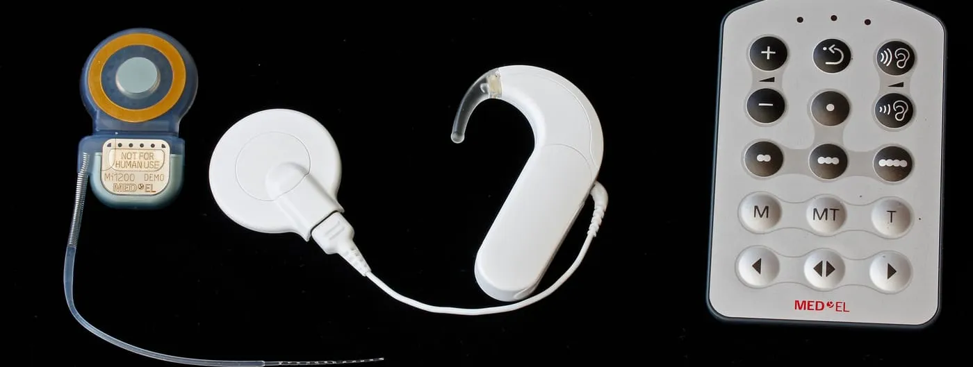A conventional cochlear implant system on a black background: the surgically implanted receiver with its thin electrode array, beside the external coil, a behind-the-ear speech processor and a handheld remote.