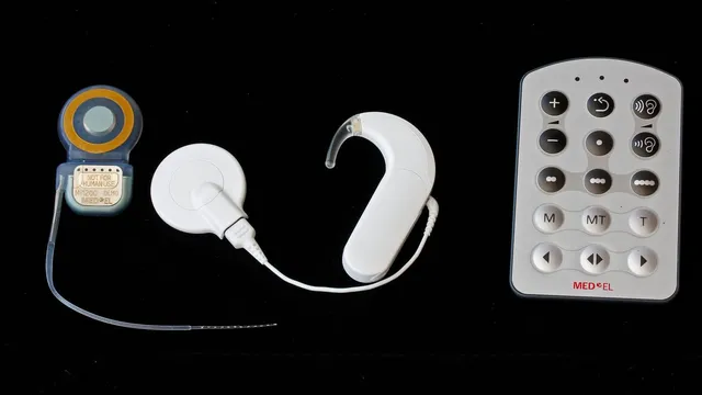 A conventional cochlear implant system on a black background: the surgically implanted receiver with its thin electrode array, beside the external coil, a behind-the-ear speech processor and a handheld remote.