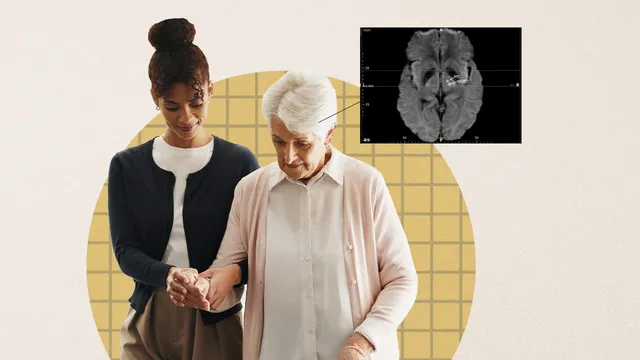 An annotated axial MRI brain scan marking the PTT and ndDRTT tract targets, linked by a line to an illustration of a caregiver helping an older woman walk.