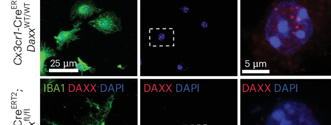 Confocal immunofluorescence images of mouse microglia stained green for IBA1 with DAXX in red and nuclei in blue, the top row showing abundant DAXX puncta and the bottom row showing knockout cells without them.
