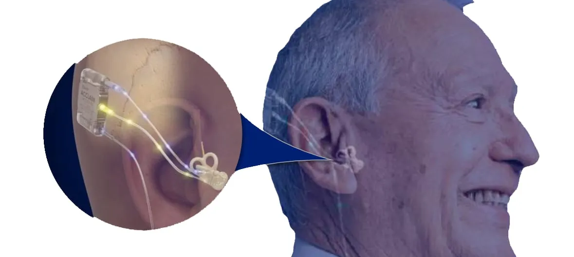 A diagram of an older man in profile with a circular cutaway over his ear, showing an implant seated behind the ear and a thin electrode lead curling into the spiral of the cochlea.