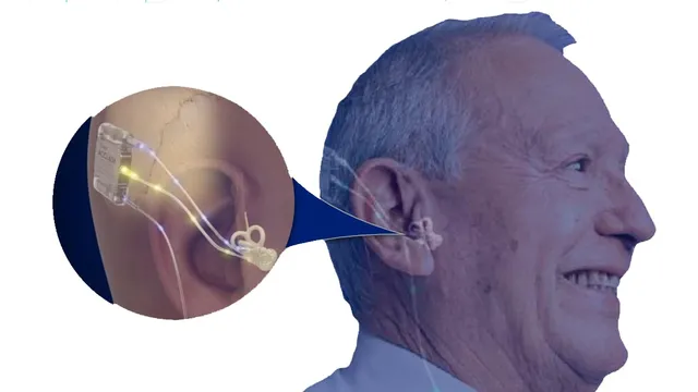 A diagram of an older man in profile with a circular cutaway over his ear, showing an implant seated behind the ear and a thin electrode lead curling into the spiral of the cochlea.