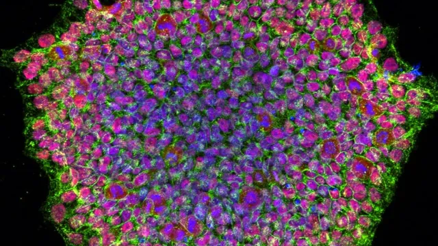 Fluorescence micrograph of a human induced pluripotent stem cell colony, a dense round cluster of cells with magenta nuclei outlined by green cell borders against black.