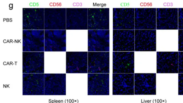 A grid of immunofluorescence micrographs of mouse spleen and liver tissue stained for CD5, CD56 and CD3, comparing CAR-NK, CAR-T, NK and control treatments, with far fewer CD5-positive tumour cells in the CAR-NK panels.