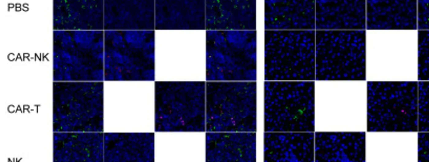 A grid of immunofluorescence micrographs of mouse spleen and liver tissue stained for CD5, CD56 and CD3, comparing CAR-NK, CAR-T, NK and control treatments, with far fewer CD5-positive tumour cells in the CAR-NK panels.