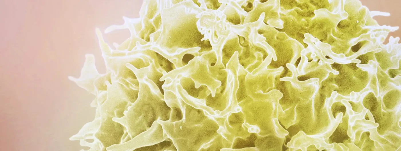 A colourised scanning electron micrograph of a single T lymphocyte, its ruffled yellow surface filling the frame against a pale pink background.