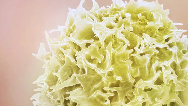 A colourised scanning electron micrograph of a single T lymphocyte, its ruffled yellow surface filling the frame against a pale pink background.
