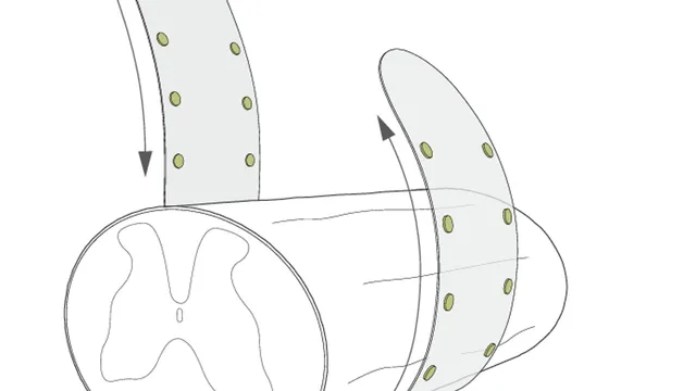 A line diagram of a spinal cord segment shown in cross-section, with a flexible band of round electrodes curving down and around its outer surface like a cuff.