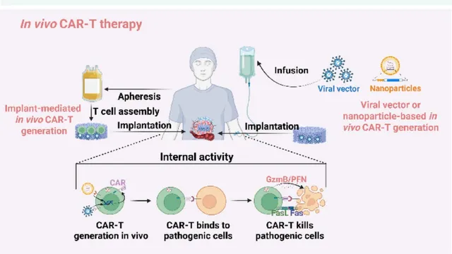 Diagram of in vivo CAR-T therapy showing a patient receiving an intravenous infusion of viral vector or nanoparticles that generate CAR T cells inside the body, with a lower panel illustrating those cells binding to and killing pathogenic cells.