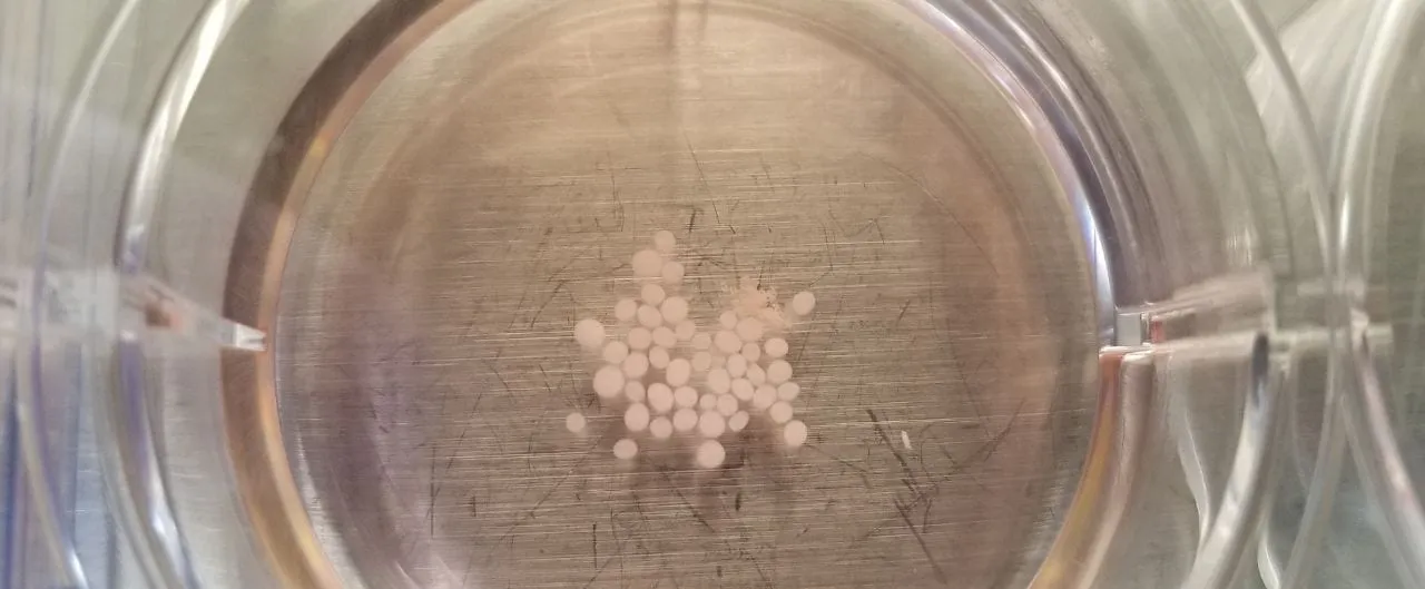Looking down into a clear culture well filled with medium, where a loose cluster of several dozen pale spherical brain organoids rests on the scratched metal surface beneath.