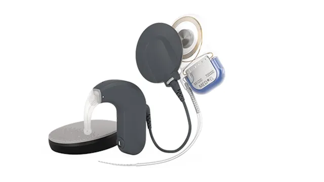 A rendered cutout of a MED-EL SONNET audio processor beside the SYNCHRONY cochlear implant and its coiled electrode array, both in dark grey and blue plastic on a white background.