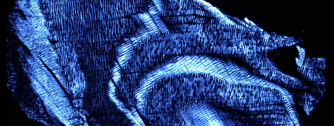 Polarised-light microscopy photograph of intervertebral disc tissue, showing the wavy blue-white collagen fibre bands of the annulus fibrosus in cross-section.