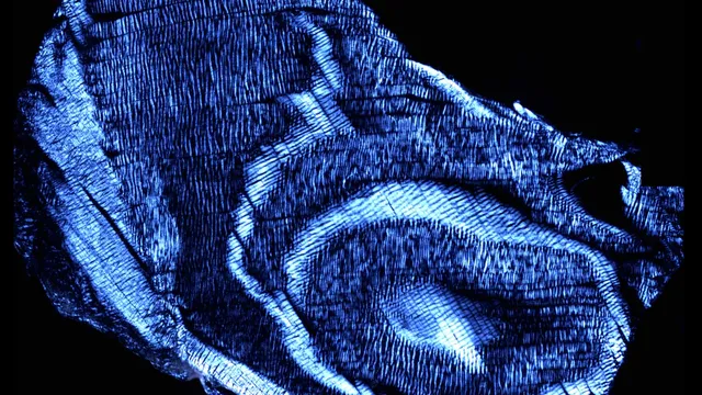 Polarised-light microscopy photograph of intervertebral disc tissue, showing the wavy blue-white collagen fibre bands of the annulus fibrosus in cross-section.