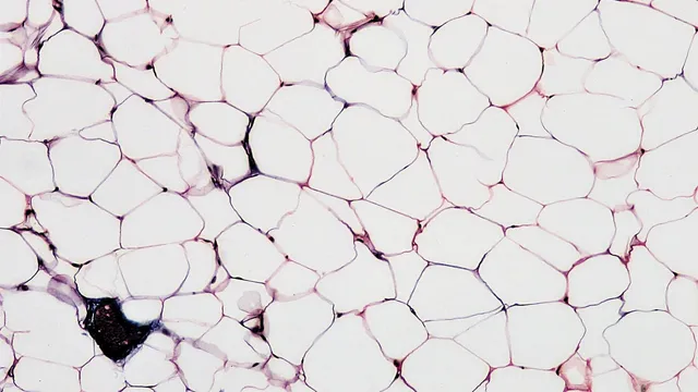 Micrograph of white adipose tissue showing a dense field of large, thin-walled fat cells separated by thin connective tissue septa.