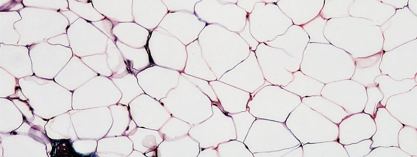Micrograph of white adipose tissue showing a dense field of large, thin-walled fat cells separated by thin connective tissue septa.