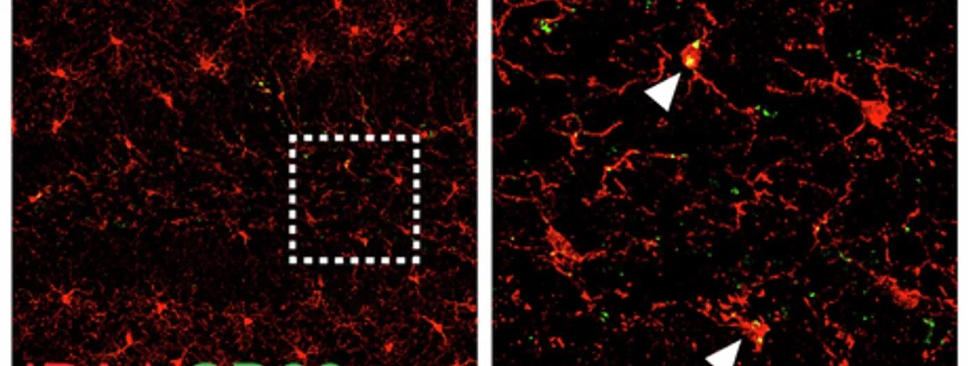 Two confocal micrographs of mouse brain tissue side by side, showing branching microglia labelled red for IBA1 with small green CD68 puncta marking lysosomes, the right panel a magnified view with arrowheads.