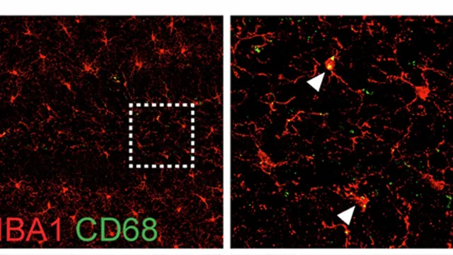 Two confocal micrographs of mouse brain tissue side by side, showing branching microglia labelled red for IBA1 with small green CD68 puncta marking lysosomes, the right panel a magnified view with arrowheads.