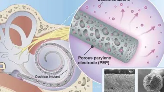 A diagram of a coiled cochlear implant electrode inside the cochlea sits beside a cutaway showing the porous electrode releasing drug particles, with electron microscope cross-sections of the electrode alongside.