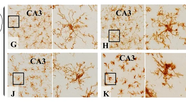 Four brown-stained immunohistochemistry micrographs of ramified microglial cells in the hippocampal CA3 region, each paired with a close-up of a single highlighted cell.