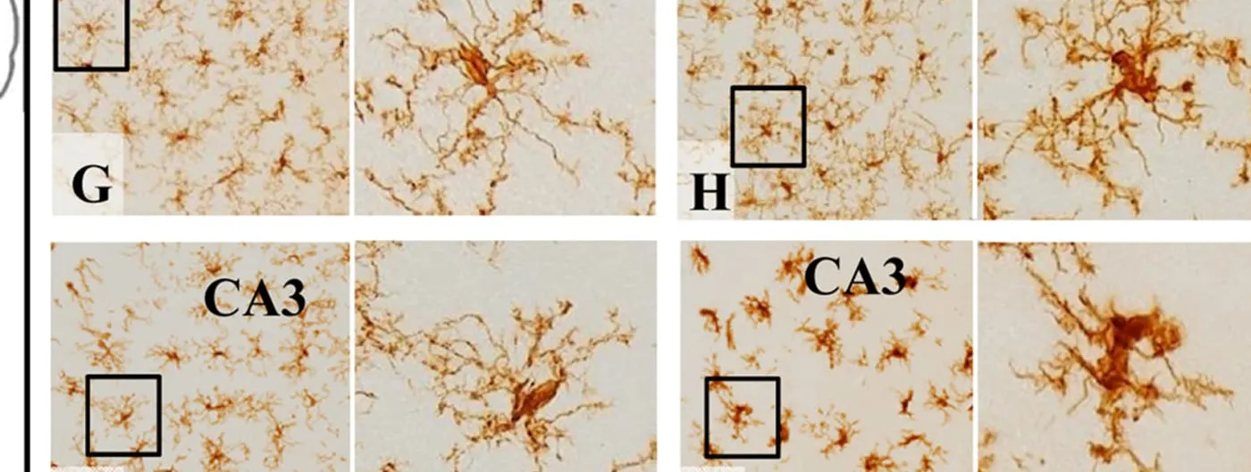 Four brown-stained immunohistochemistry micrographs of ramified microglial cells in the hippocampal CA3 region, each paired with a close-up of a single highlighted cell.