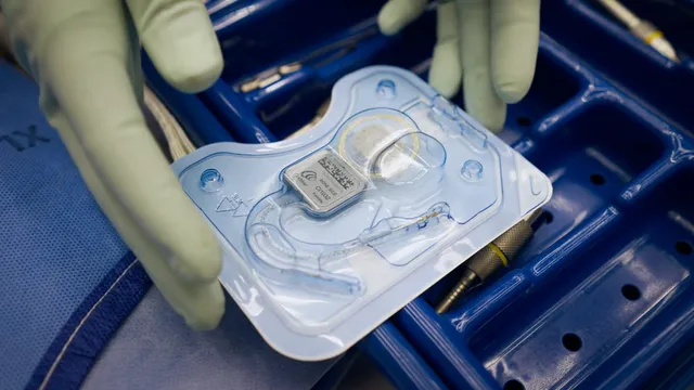 Two gloved hands lift a sealed sterile blister pack holding a cochlear implant — a small square receiver-stimulator with a coiled electrode lead — above a blue perforated surgical instrument tray.