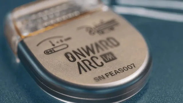 Close-up of a rounded metal implantable pulse generator lying on a blue-grey surface, its titanium face laser-engraved with the ONWARD ARC IM name, a small diagram and the serial number SN FEAS007, with translucent lead connectors entering the header.