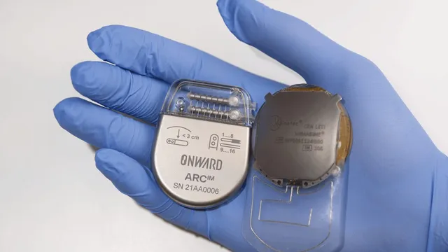 A gloved hand holds ONWARD Medical's ARC-IM implantable neurostimulator next to the paired WIMAGINE brain-computer-interface implant, showing both pieces of hardware that make up the ARC-BCI system.