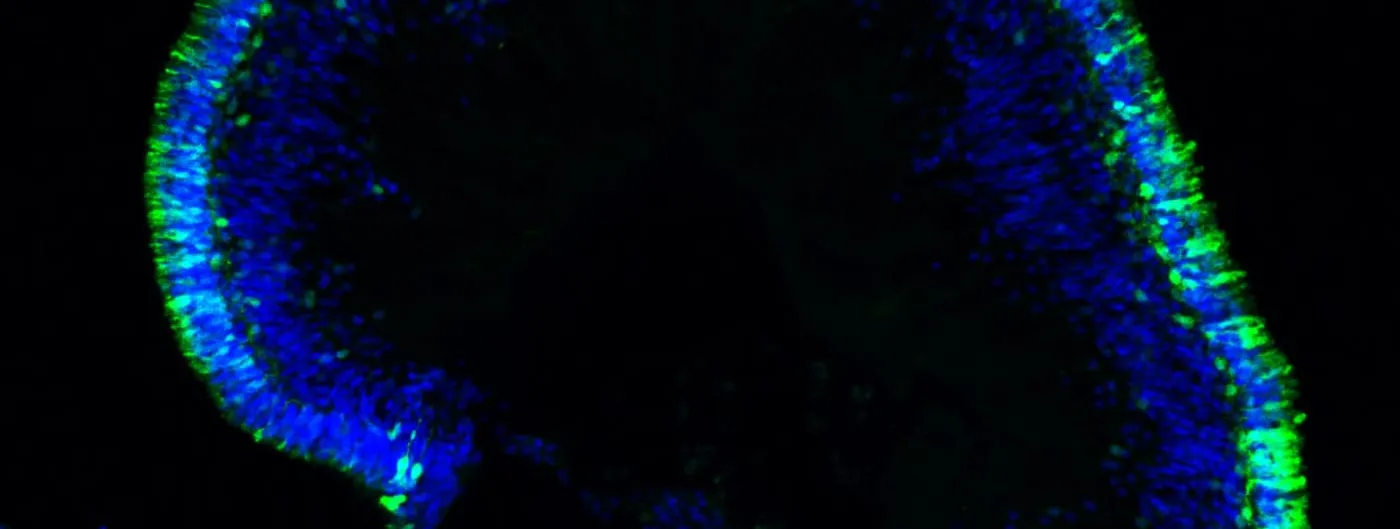 Confocal fluorescence micrograph of a lab-grown retinal organoid: a curved layer of blue-stained cell nuclei rimmed with bright green photoreceptor-like cells against a black background.