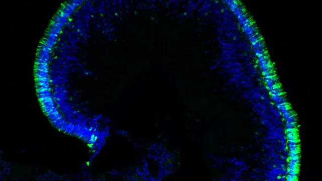 Confocal fluorescence micrograph of a lab-grown retinal organoid: a curved layer of blue-stained cell nuclei rimmed with bright green photoreceptor-like cells against a black background.