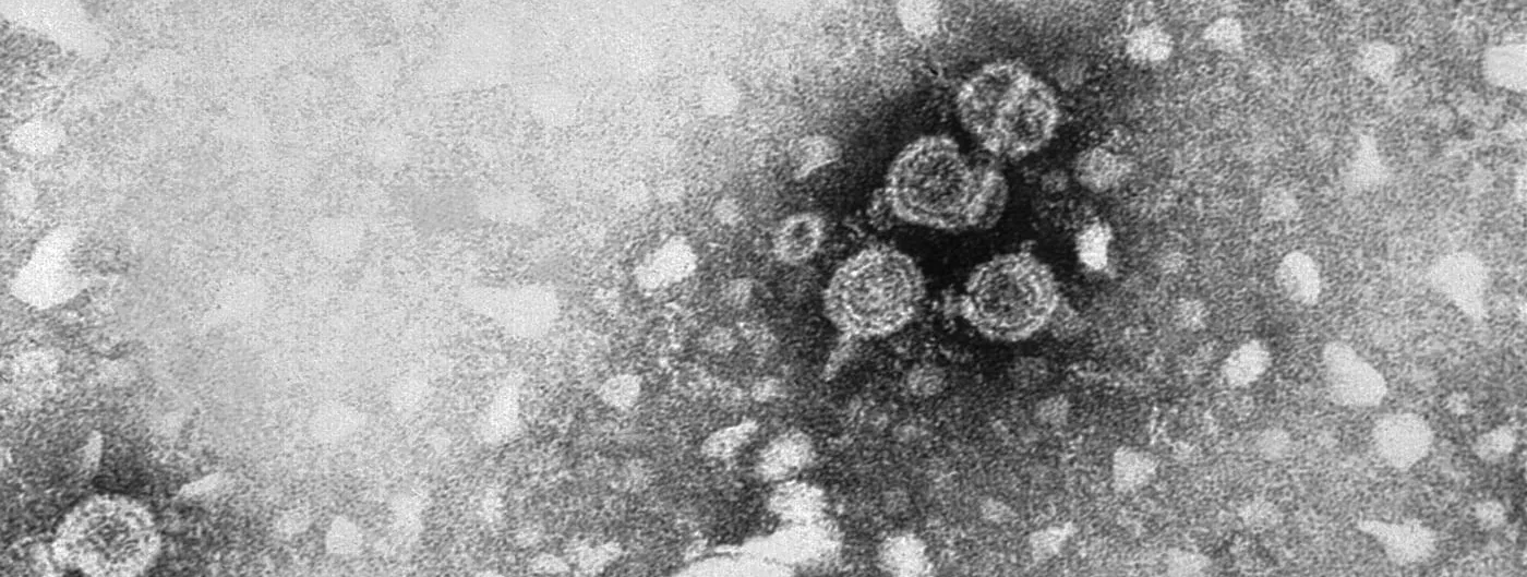 Transmission electron micrograph showing a cluster of round hepatitis B virions, the Dane particles, surrounded by smaller spherical surface-antigen particles.