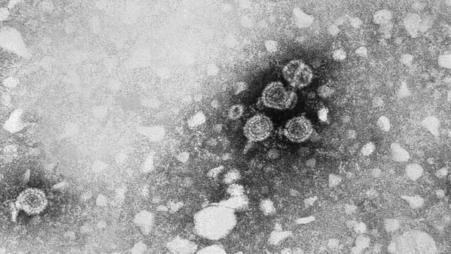 Transmission electron micrograph showing a cluster of round hepatitis B virions, the Dane particles, surrounded by smaller spherical surface-antigen particles.