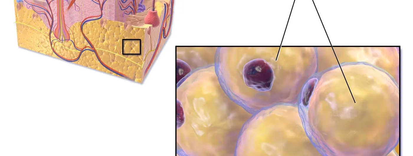 A medical illustration of adipose tissue: a cutaway block of skin with a yellow layer of fat beneath it, beside a magnified panel of rounded white adipose cells packed together.