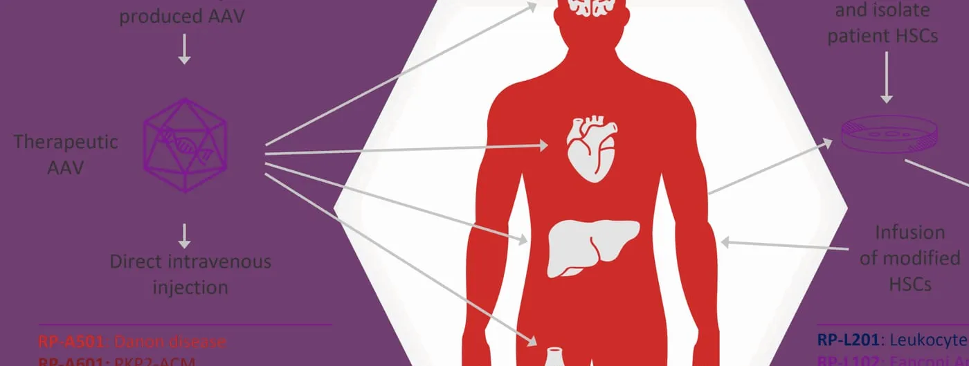 A purple Rocket Pharmaceuticals diagram labelled RP-A501 Danon disease, showing an icosahedral AAV capsid delivered by intravenous injection into a human silhouette with arrows to the heart and other organs.