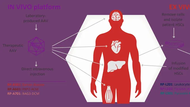 A purple Rocket Pharmaceuticals diagram labelled RP-A501 Danon disease, showing an icosahedral AAV capsid delivered by intravenous injection into a human silhouette with arrows to the heart and other organs.