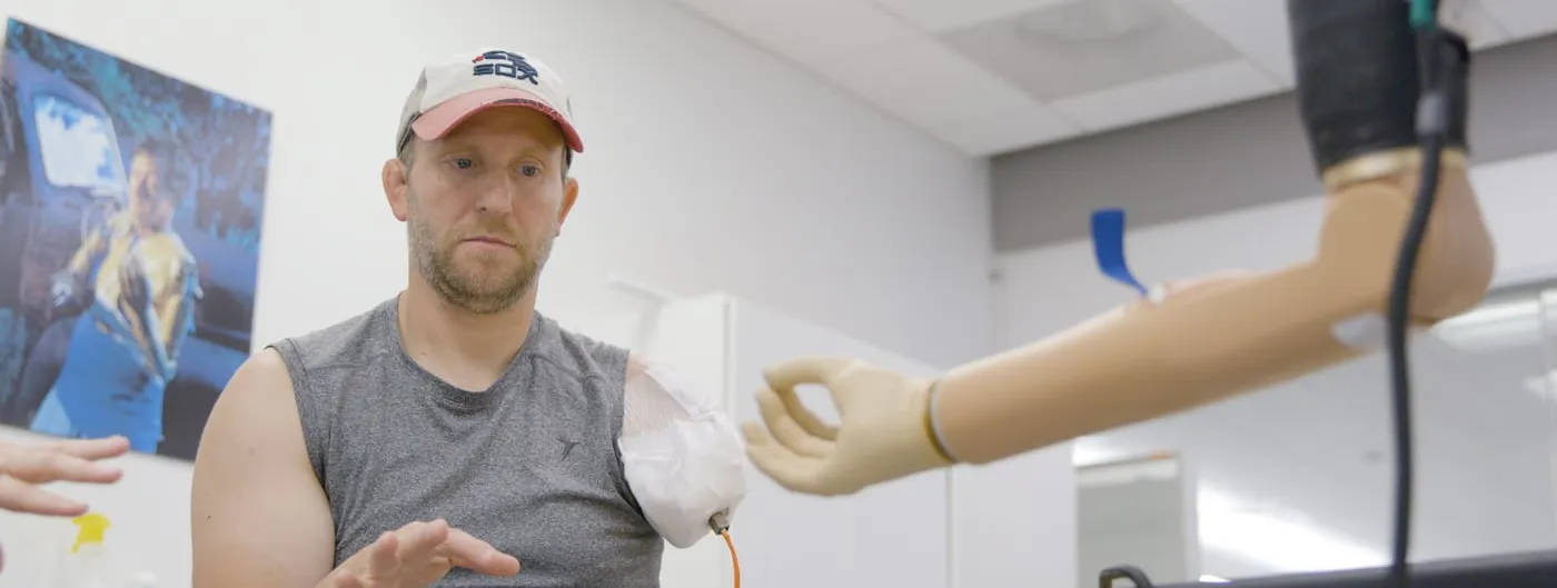 A seated patient wearing a baseball cap looks toward a bone-anchored prosthetic arm reaching into frame from an overhead mount in a clinical exam room.