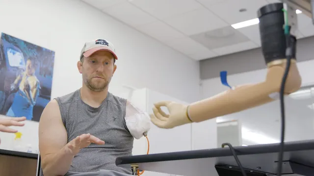 A seated patient wearing a baseball cap looks toward a bone-anchored prosthetic arm reaching into frame from an overhead mount in a clinical exam room.
