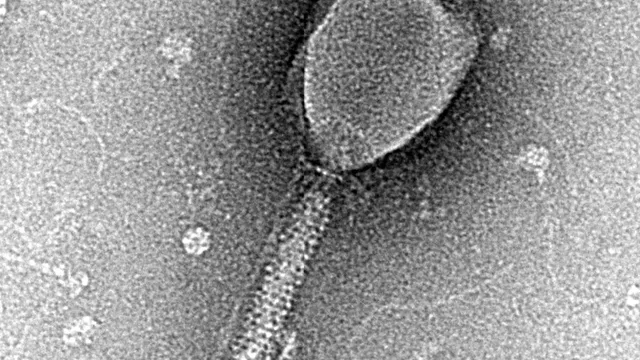 Transmission electron micrograph of an Enterobacteria phage T2 particle, a bacteriophage that infects E. coli.