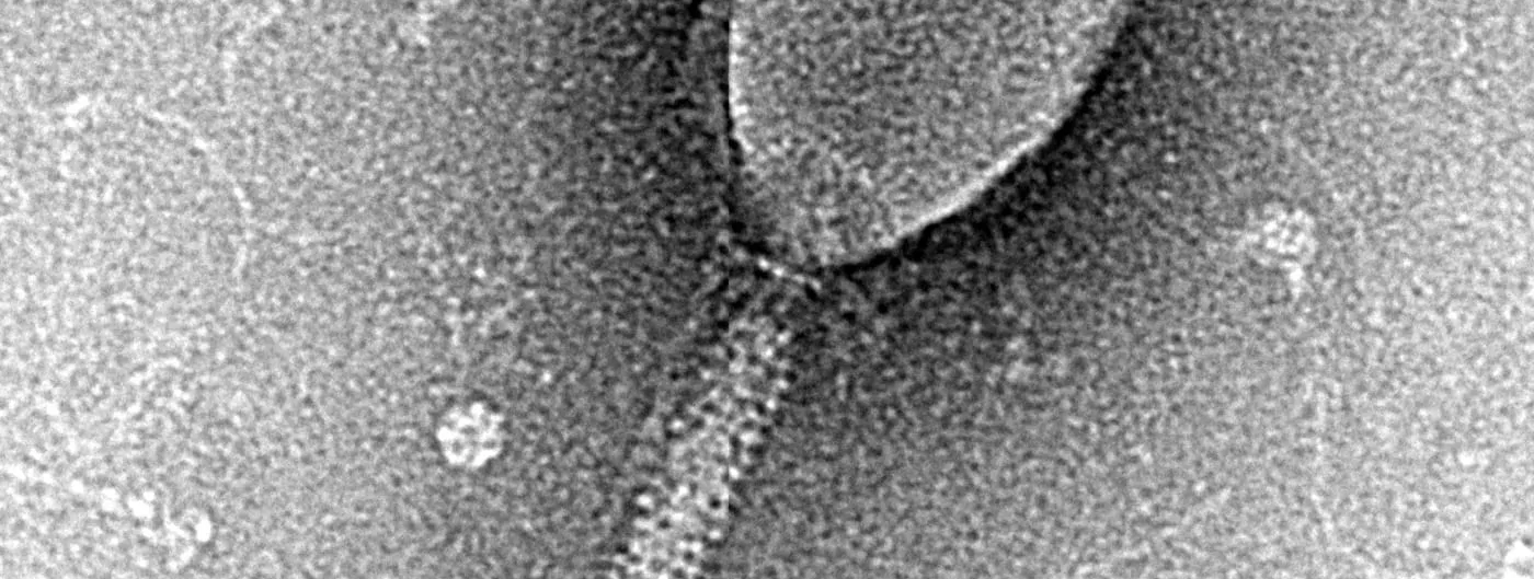 Transmission electron micrograph of an Enterobacteria phage T2 particle, a bacteriophage that infects E. coli.