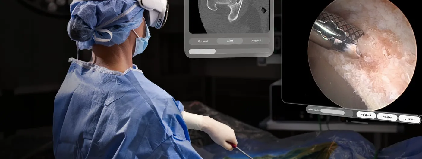 A gowned surgeon wearing a head-mounted display operates on a draped patient, with floating panels beside them showing a hip CT slice and a live arthroscopic camera view.