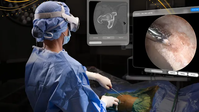 A gowned surgeon wearing a head-mounted display operates on a draped patient, with floating panels beside them showing a hip CT slice and a live arthroscopic camera view.