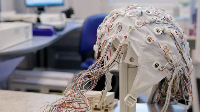 An electrode cap sits on a white stand on a clinic bench, dozens of coloured leads running from its sensors down to a connector box, with monitors and a chair out of focus behind.