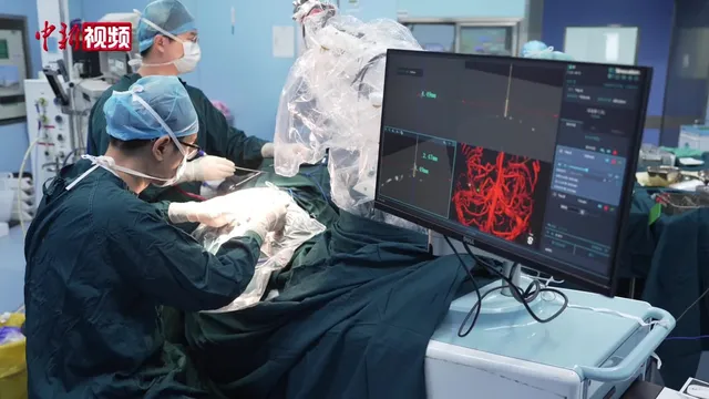 Two surgeons in green scrubs and surgical caps work over a draped patient beside a plastic-sheathed robotic arm, while a monitor at the right shows a stereotactic navigation view with a red three-dimensional reconstruction of brain vasculature and millimetre coordinates.